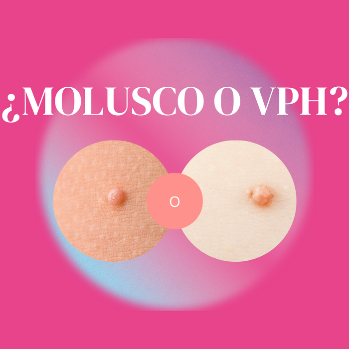 Molusco contagioso y el VPH, diferencias y similitudes.